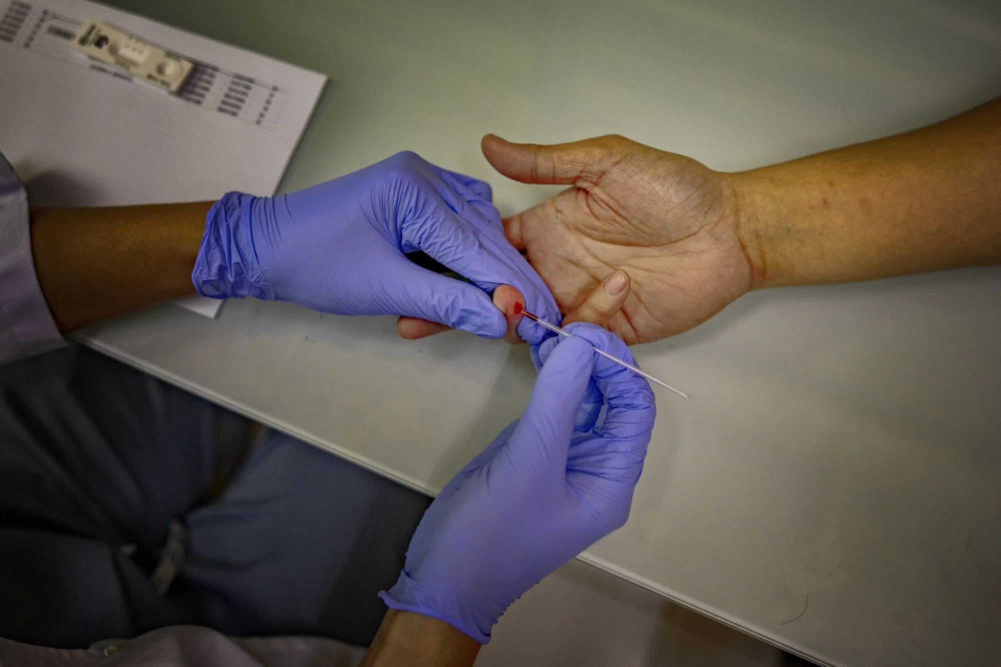 Donald Trump&nbsp;has dismantled the USAID that, among other impacts, has disrupted HIV/Aids treatment programs.